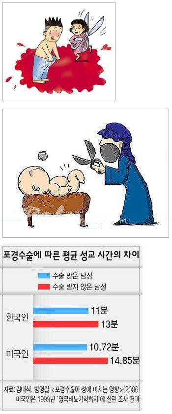 대한민국 남성 포경수술 비율 확 줄었다.jpg