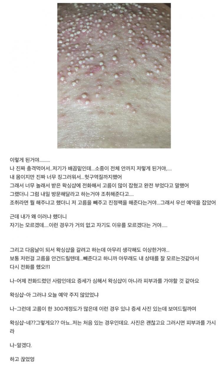 혐)  어떤이의 왁싱 후유증