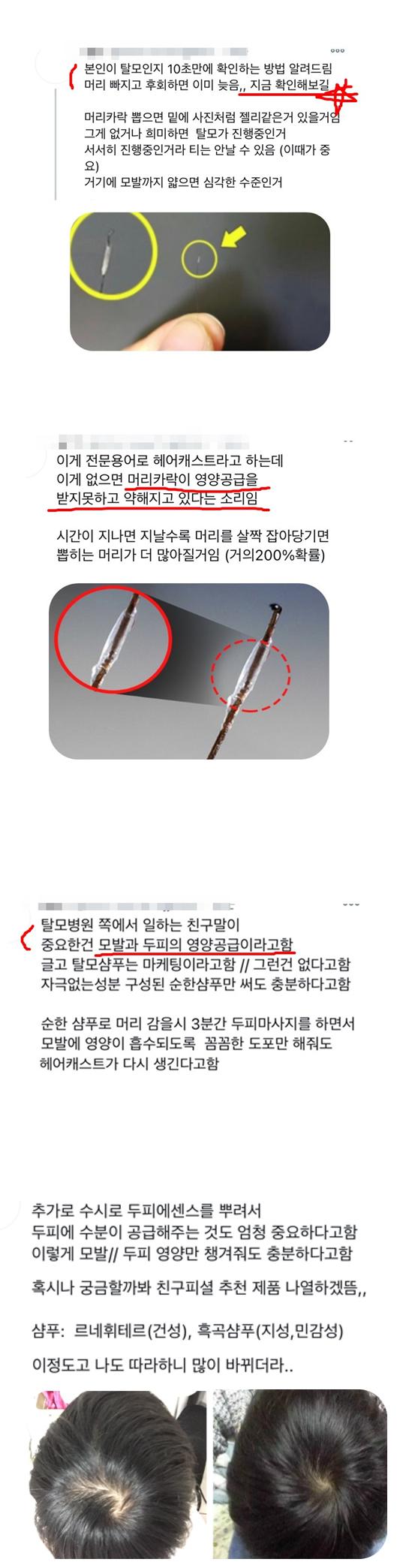 머머리 10초 자가진단법