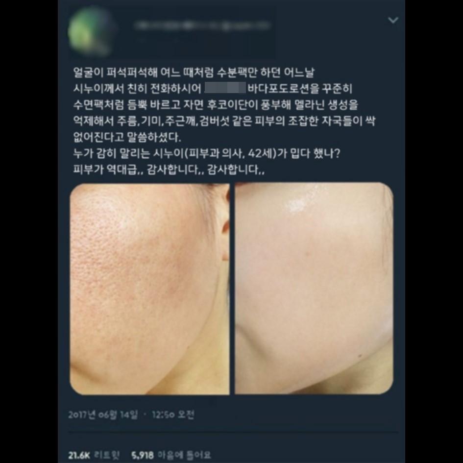 의사들이 말하는 교대근무 수면문제